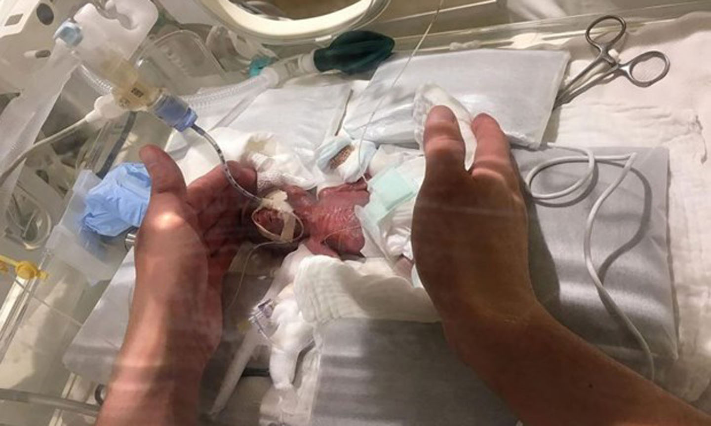 Cậu bé được cho là đang giữ kỷ lục cậu bé sơ sinh nhỏ nhất được xuất viện trong tình trạng sức khỏe tốt. (Nguồn: AFP)