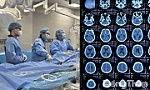 Can thiệp mạch máu não - Bước tiến mới của Bệnh viện Đa khoa Tiền Giang